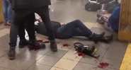 Vítima dos ataques ao metrô de Nova York - Divulgação/ Redes Sociais