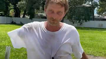 Eric Merda com o braço amputado após ataque de jacaré - Reprodução/vídeo/10 Tampa Bay