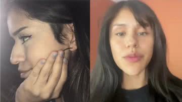 Garota norte-americana mostrando o resultado da plástica no nariz - Reprodução/video/@userg01728011