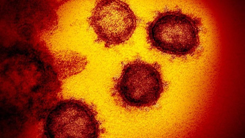 Imagem de laboratório do novo coronavírus