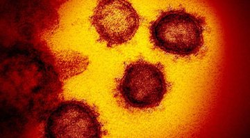 Imagem de laboratório do novo coronavírus - Divulgação/NIAID/NIH