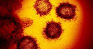Imagem de laboratório do novo coronavírus - Divulgação/NIAID/NIH