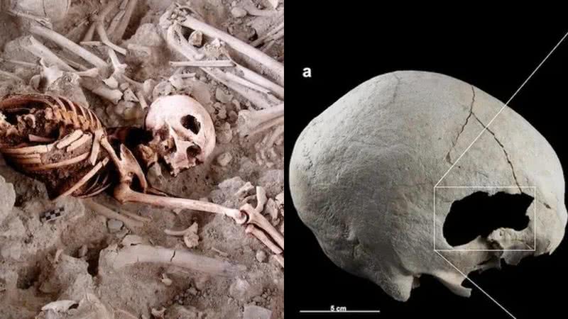 O esqueleto encontrado com dois buracos - Reprodução / Sonia Díaz-Navarro et al