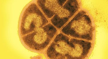 A Deinococcus radiodurans - Wikimedia Commons