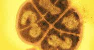 A Deinococcus radiodurans - Wikimedia Commons