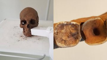 Crânio e dentes vikings analisados pelo estudo - Reprodução/Universidade de Gotemburgo/Carolina Bertilsson