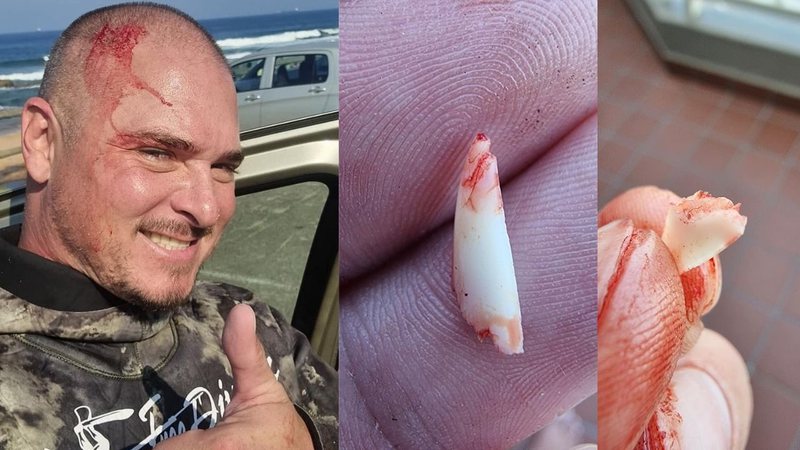 Fotografia de Jarid e dos pedaços do dente de tubarão - Divulgação / Facebook