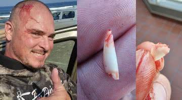 Fotografia de Jarid e dos pedaços do dente de tubarão - Divulgação / Facebook