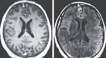 Imagem de ressonância magnética da cabeça do paciente - Divulgação / Massachusetts Medical Society