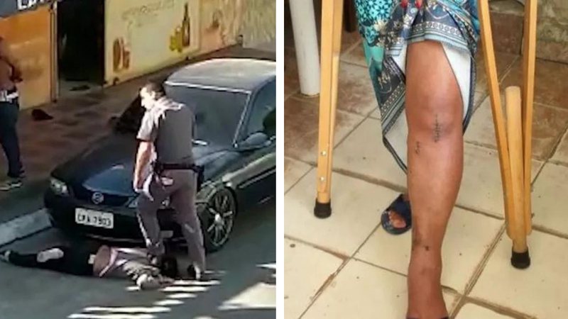 Mulher que teve pescoço pisado por policial também quebrou a perna - Divulgação / TV Globo