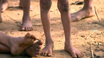 Pernas de crianças yanomami com desnutrição - Divulgação / vídeo / TV Globo