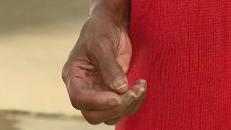 Mão de idosa que foi mantida em condições análogas à escravidão - Divulgação / vídeo / TV Globo