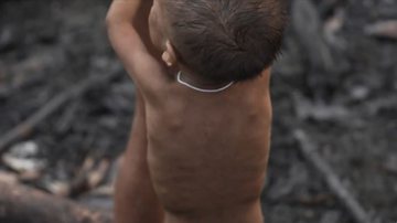 Criança Yanomami - Divulgação / vídeo / g1