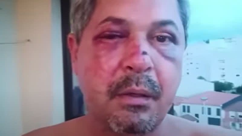 Brasileiro foi agredido em Portugal - Divulgação / vídeo / UOL