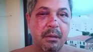 Brasileiro foi agredido em Portugal - Divulgação / vídeo / UOL