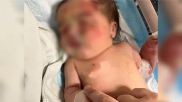Bebê foi encontrada com hematomas dentro de sacola - Divulgação / Redes sociais