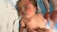 Bebê foi encontrada com hematomas dentro de sacola - Divulgação / Redes sociais