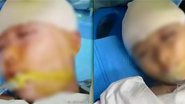 Menina de 9 anos sofreu traumatismo craniano - Divulgação/Weibo