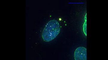 A organela recém-descoberta (ponto verde-amarelo) fica no citoplasma próximo ao núcleo (azul) - Divulgação/Schenkel L. et al. Molecular Biology of the Cell