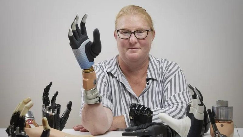 A sueca Karin - Divulgação/Bionics Institute