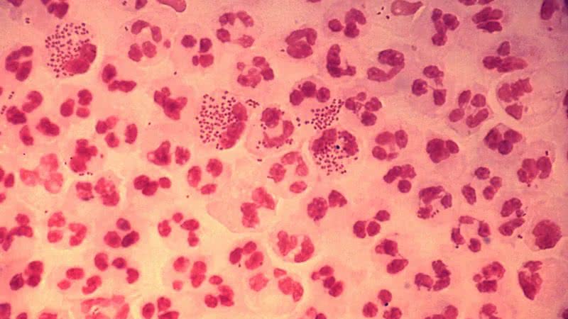 A bactéria 'Neisseria gonorrhoeae', causadora da gonorreia, infecção sexualmente transmissível - Divulgação/CDC