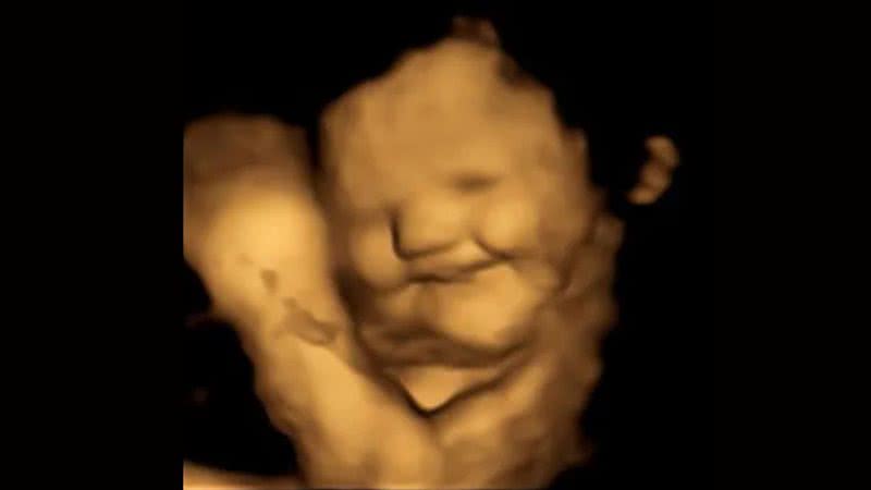 Ultrassonografia mostra feto sorrindo ao ingerir alimento - Fetap Study / Fetal and Neonatal Research Lab / Durham University