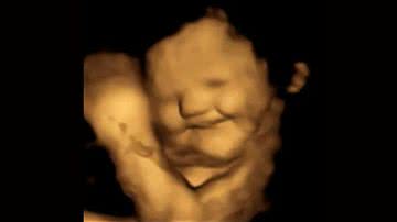 Ultrassonografia mostra feto sorrindo ao ingerir alimento - Fetap Study / Fetal and Neonatal Research Lab / Durham University