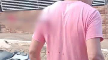 Imagem borrada de vítima com flecha cravada nas costas - Reprodução/Inter TV