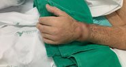 O homem teve a mão reimplantada - Divulgação/Hospital Santo Antônio