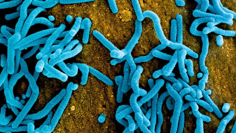 Partículas do vírus Marburg (azul) sobre a superfície de uma célula infectada (laranja) - Reprodução/Twitter