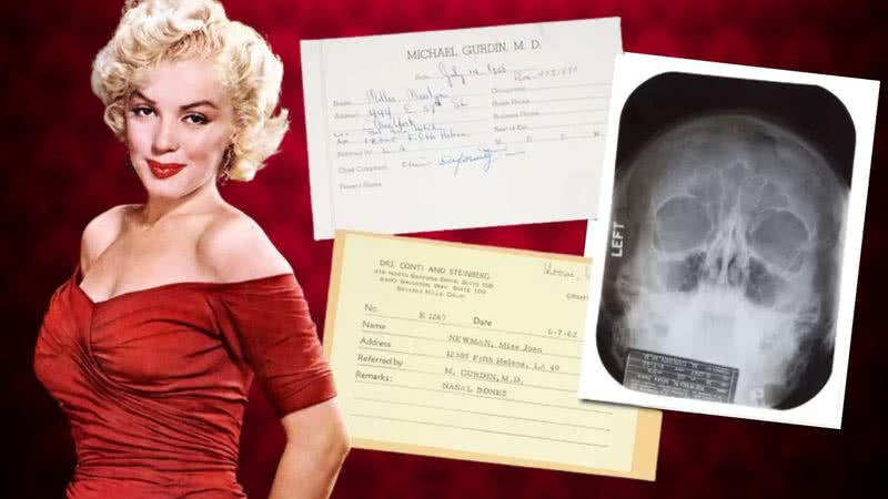Montagem de Marilyn Monroe com documentos médicos