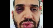 Foto do médico que foi agredido no Paraná - Divulgação/Instagram