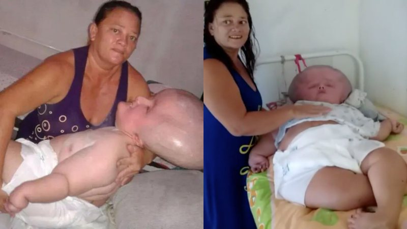 Mulher com hidrocefalia congênita fez 29 anos de idade - Divulgação / Instagram