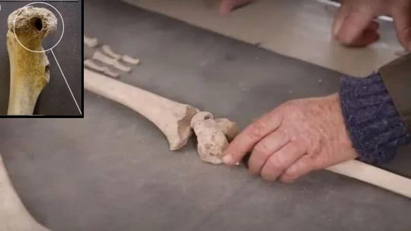 Esqueleto com furos - Divulgação/ Smithsonian Channel