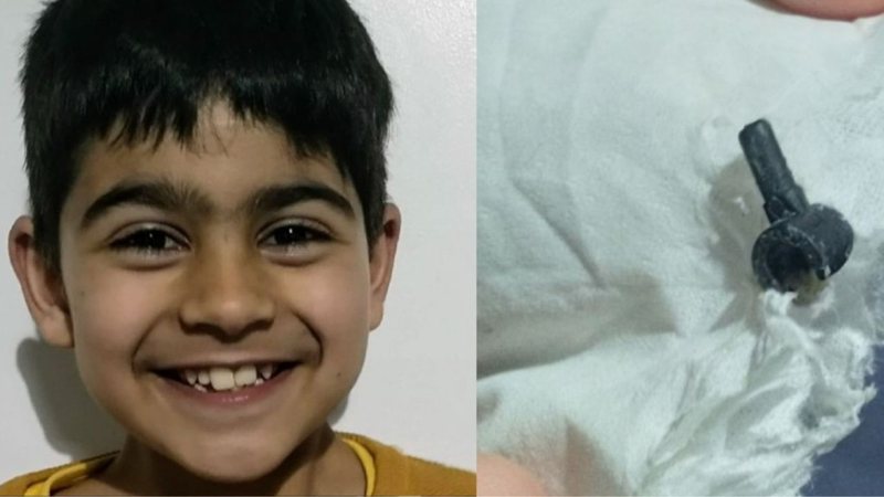 Fotografia do garoto ao lado da peça de Lego que estava em seu nariz - Divulgação /Arquivo pessoal /Mudassir Anwar