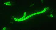 Yersinia pestis, bactéria que causa a peste bubônica - Wikimedia Commons