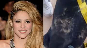 Montagem de Shakira ao lado de sua mochila, após ataque de javalis - Getty Images / Divulgação/Instagram/@shakira
