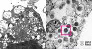 Imagem microscópica captura amostra da ômicron - Divulgação / Faculdade de Medicina da Universidade de Hong Kong