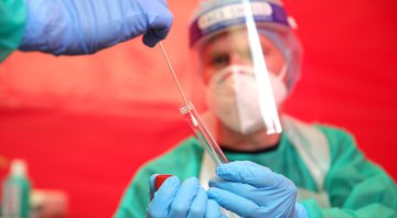 Teste de coronavírus são feitos para monitorar casos - Getty Images