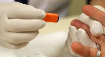 Imagem ilustrativa de teste de HIV - Divulgação/Ministério da Saúde