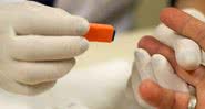 Imagem ilustrativa de teste de HIV - Divulgação/Ministério da Saúde