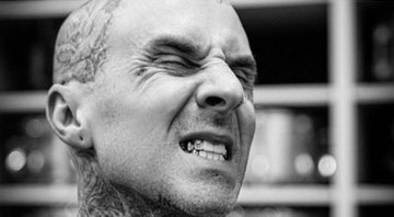 Travis Barker, baterista do Blink-182, mostra diamante no dente - Divulgação/Instagram/@connellydds