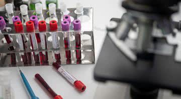 Imagem meramente ilustrativa de amostras de sangue em laboratório - Divulgação/Pixabay