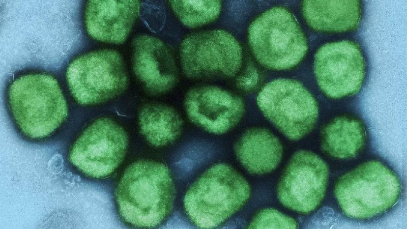 Imagem colorizada que mostra o vírus da varíola dos macacos - Instituto Nacional de Alergia e Doenças Infecciosas