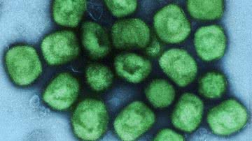 Imagem colorizada que mostra o vírus da varíola dos macacos - Instituto Nacional de Alergia e Doenças Infecciosas