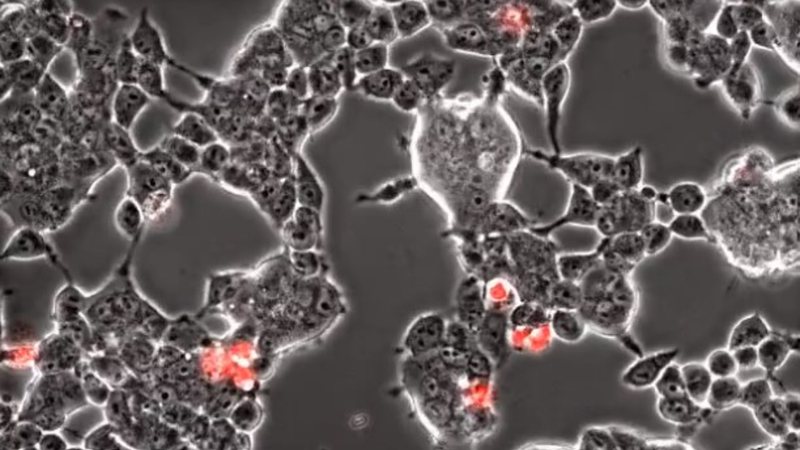 Vídeo microscópico revela coronavírus infectando células cerebrais de morcegos - Divulgação/Twitter