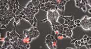 Vídeo microscópico revela coronavírus infectando células cerebrais de morcegos - Divulgação/Twitter