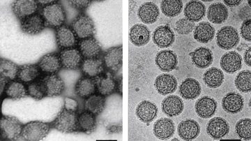 Micrografia eletrônica do vírus da febre do Vale do Rift, integrante do gênero Phlebovirus - Reprodução / C-H. von Bornsdorff.