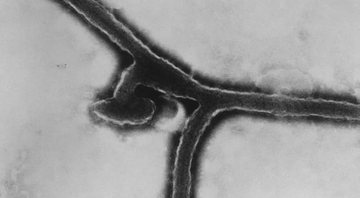 Imagem microscópica de amostra viral - Divulgação/Dr. Fredrick Murphy/Sylvia Whitfield/CDC