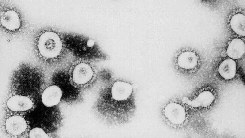 Imagem ilustrativa de vírus visto de microscópio - Getty Images